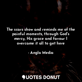  The scars show and reminds me of the painful moments, through God's mercy, His g... - Angla Media - Quotes Donut